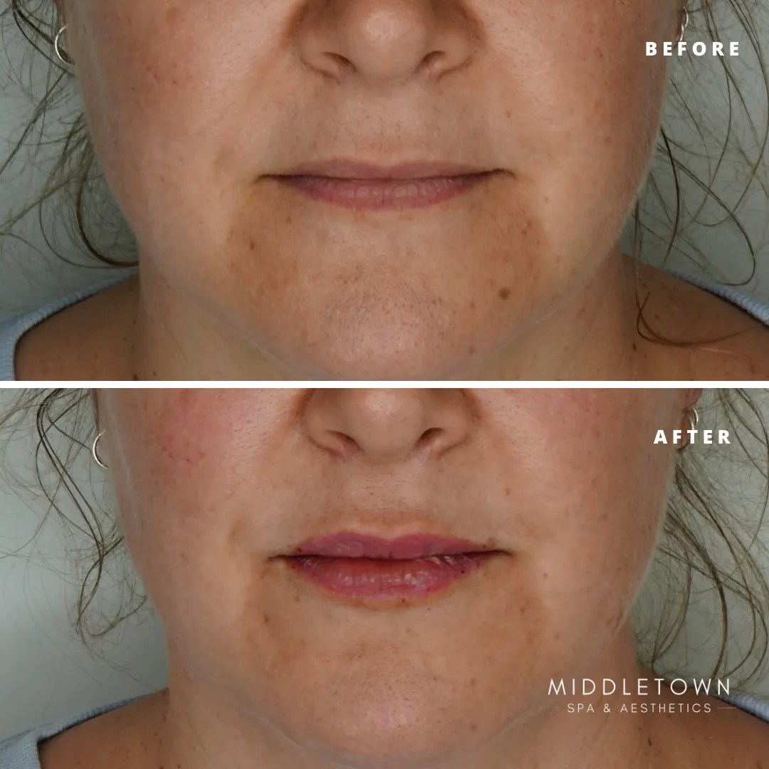 Middletown Spa Feel Good In Your Skin Middletown, KY