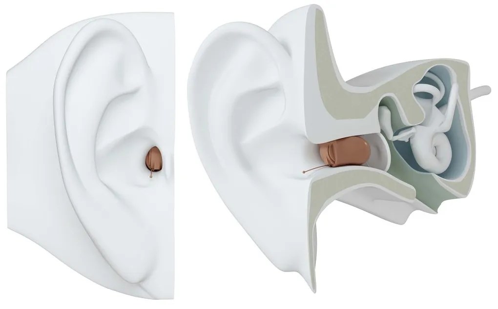 Hearing Aids inLivonia, MI Westland, MI & Farmington Hills, MI