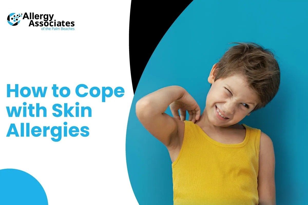 How to Cope with Skin Allergies