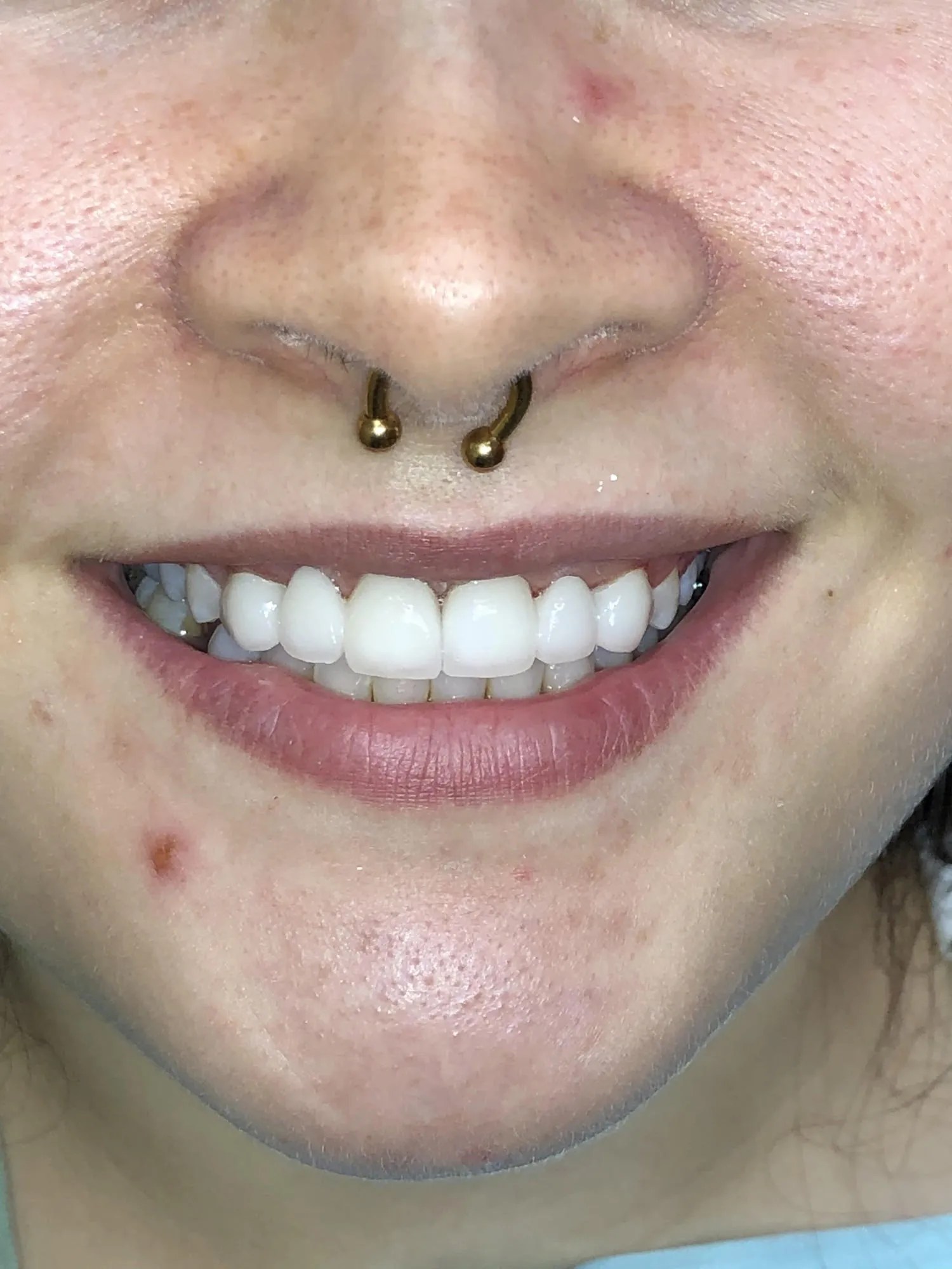 The Premier Choice for the Best Cosmetic Dentist in San Diego