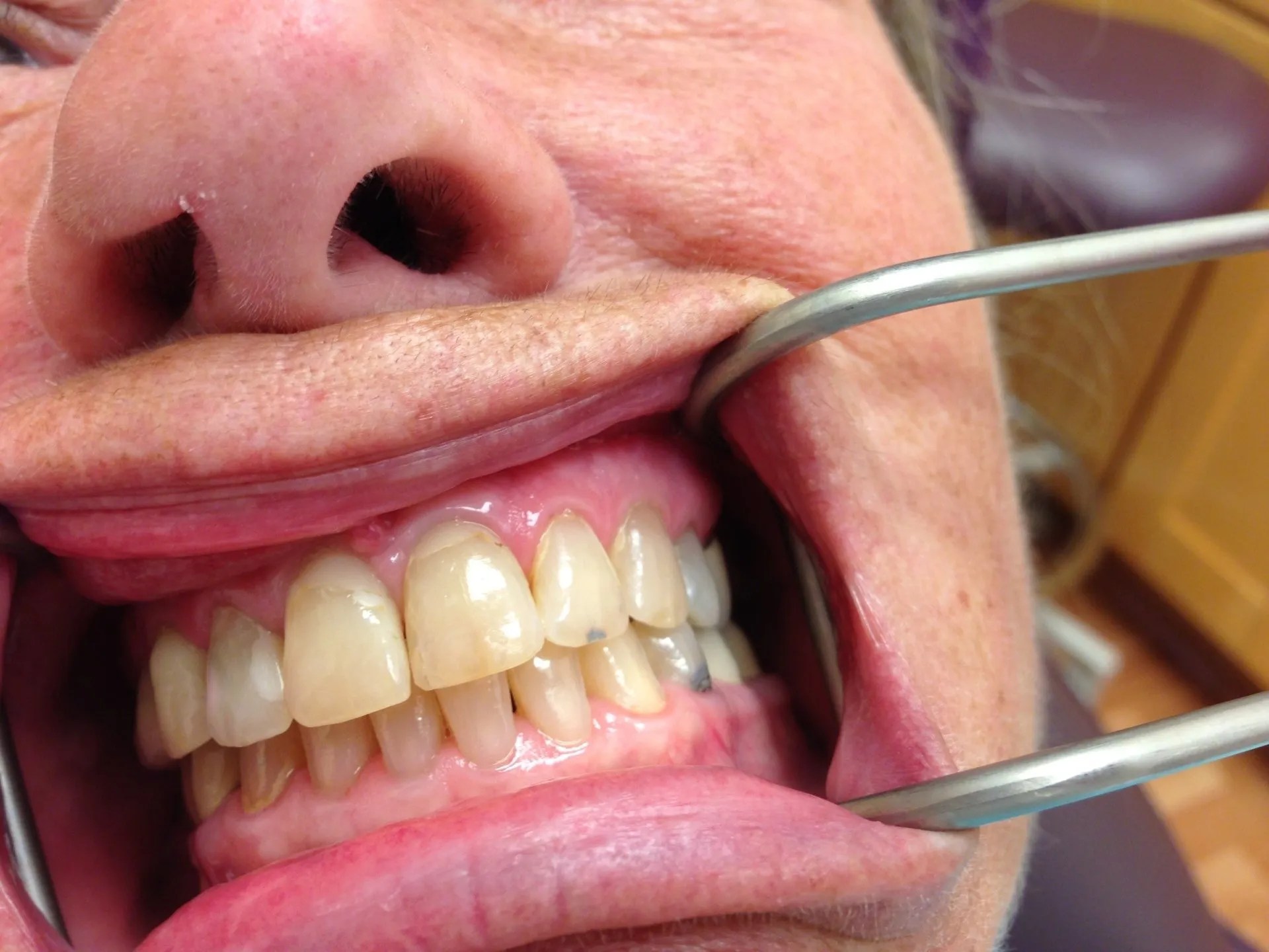Loma Vista Dental Fresno & Clovis Dentist