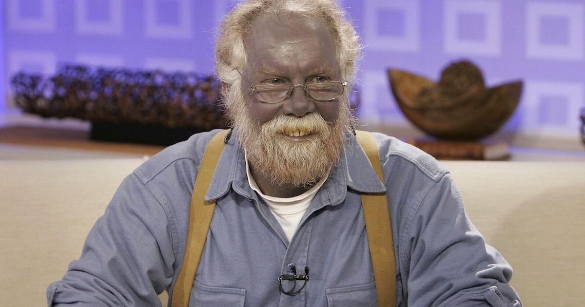 20 Bizarre People That Look Far From Normal Humans