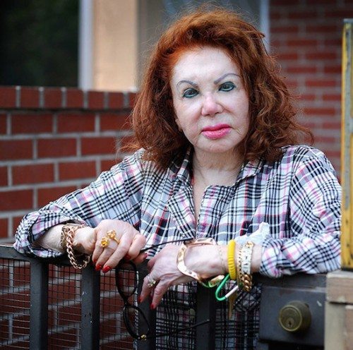 Plastic Surgery Horror Stories That Will Make You Change Your Mind