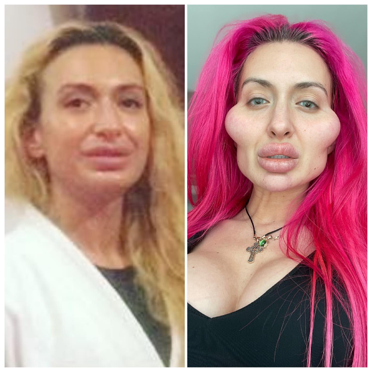 Anastasia Pokreshchuk Dünyanın En Büyük Elmacık Kemiklerine Sahip Model