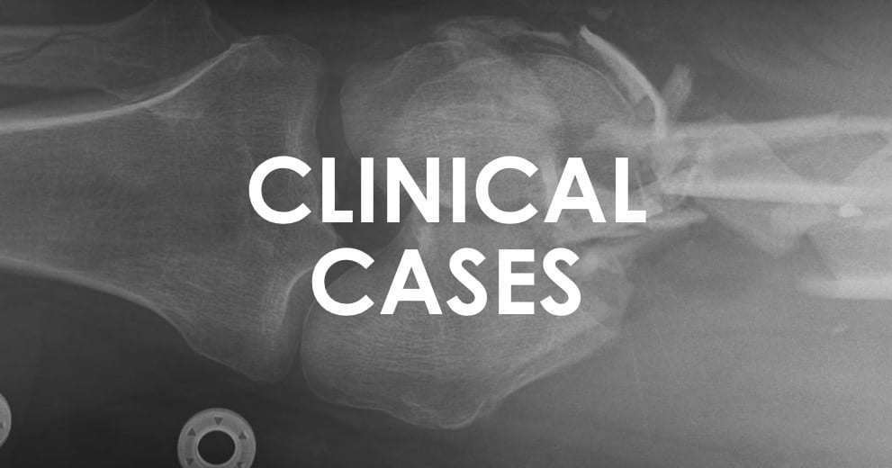 High PressureInjection Injury • LITFL • Trauma Tribulation