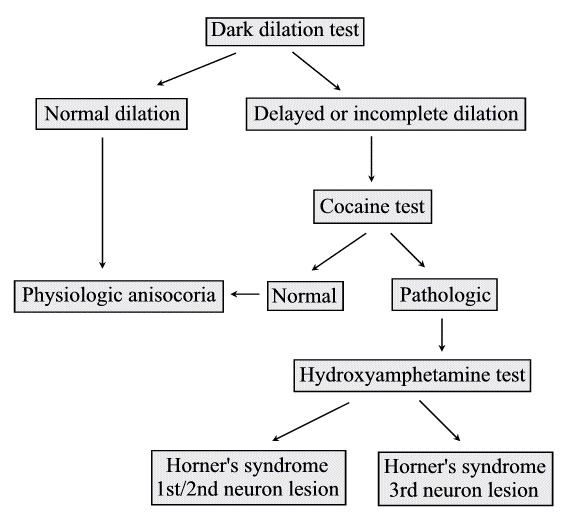 More Befuddling Pupillary Asymmetry • LITFL • Ophthalmology Befuddler