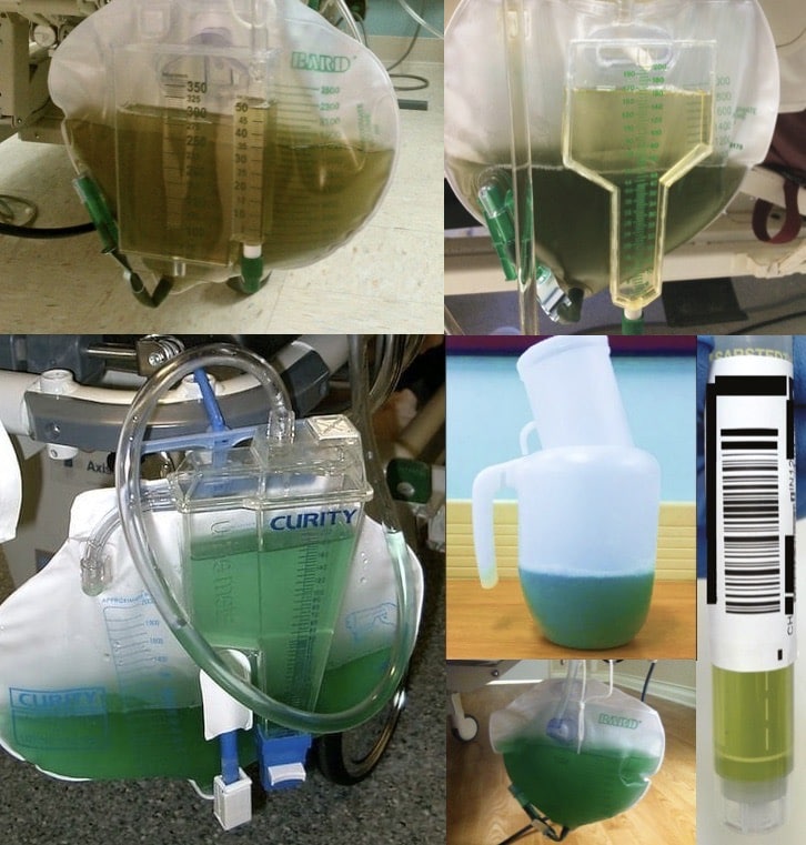 Green urine • LITFL • Unusual Urine