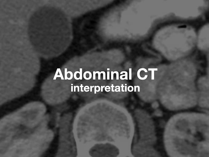 lymph nodes Archives • LITFL
