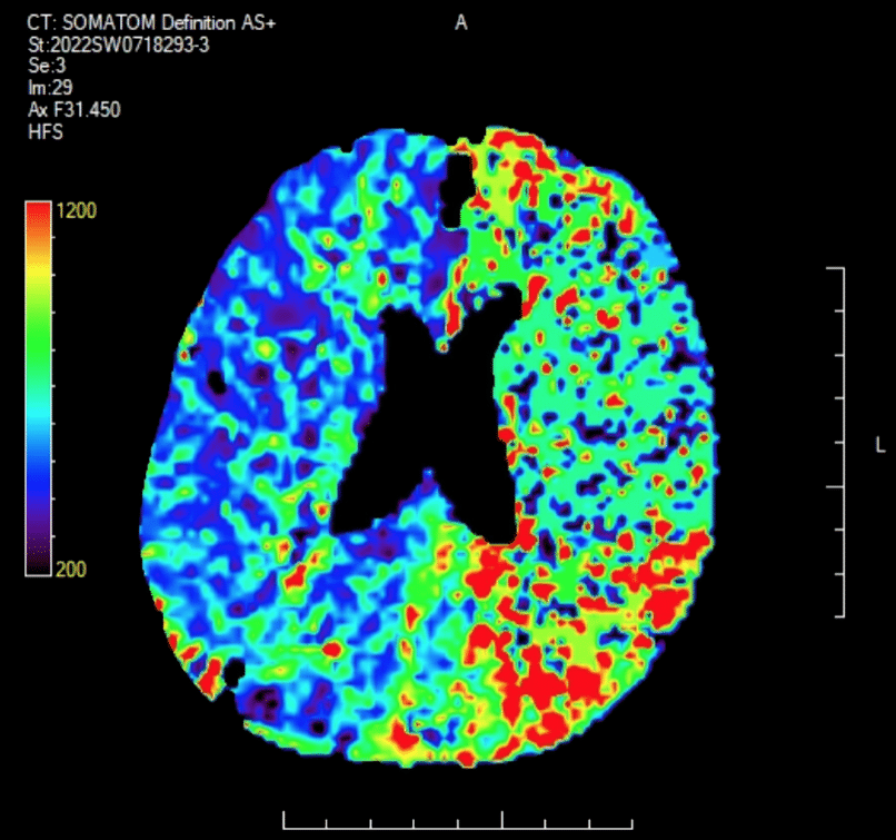 CT Case 005 • LITFL • CT scan interpretation