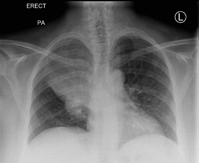 CT Case 007 • LITFL • CT scan interpretation