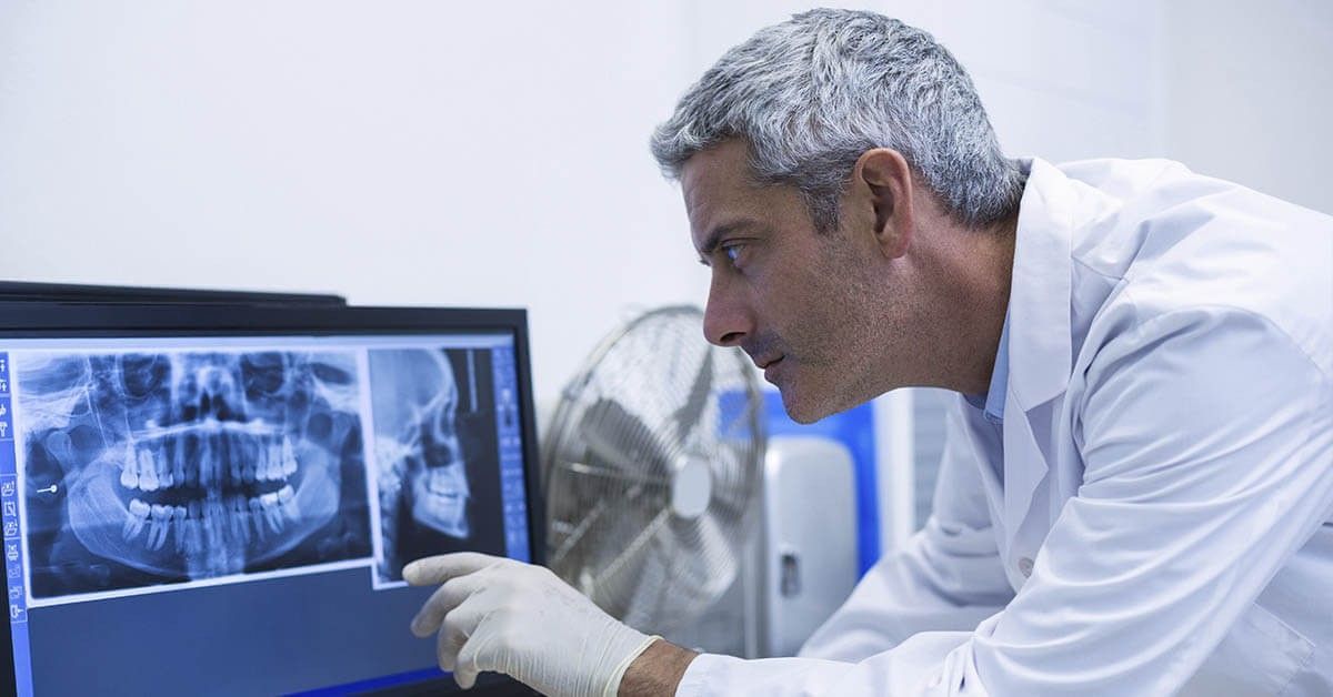 🦷 Dental Procedures Before Orthodontics【Invisable aligners】