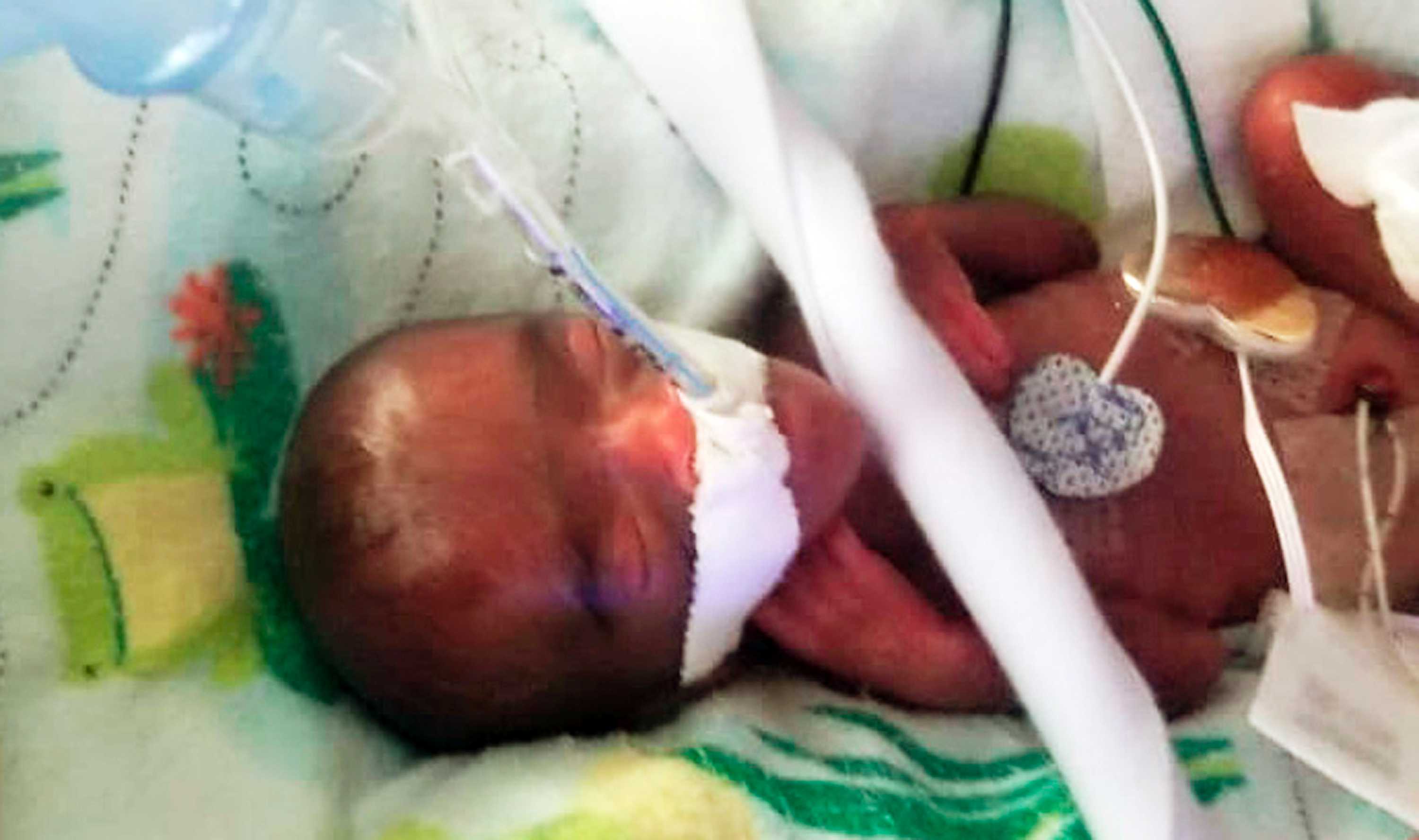 Baby Saybie, born in San Diego hospital, believed to be world's tiniest