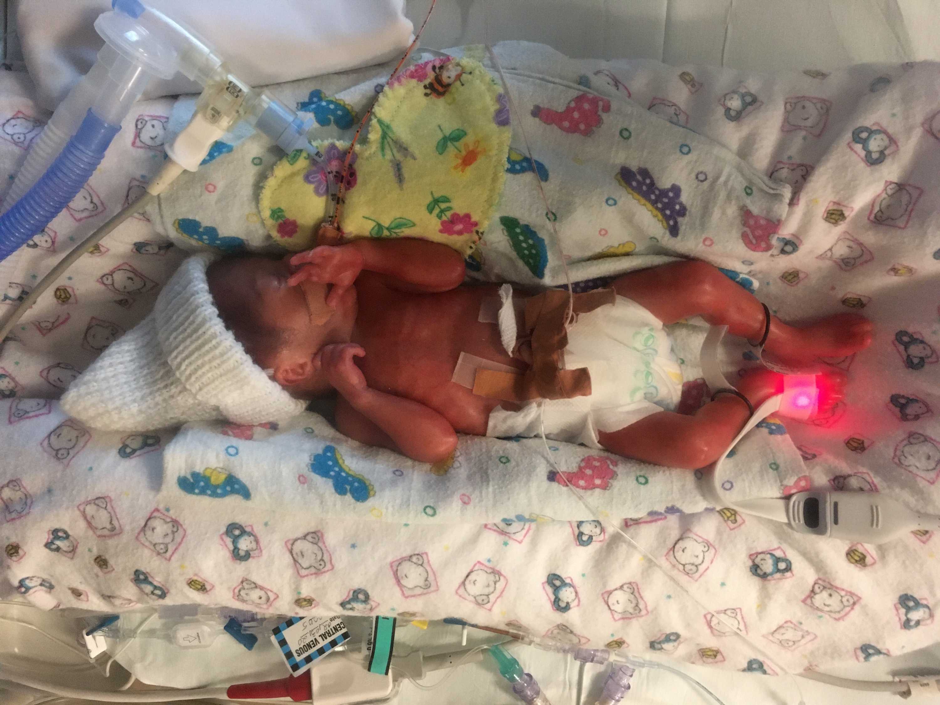 How to support someone grieving the death of a newborn ABC Everyday