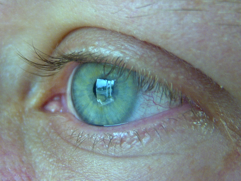 Contact Lens You can distinctly see the reflection of our … Flickr