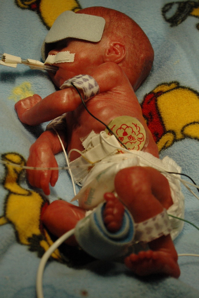 day 2 jaundice lights turned on for jaundice therapy. Eric C