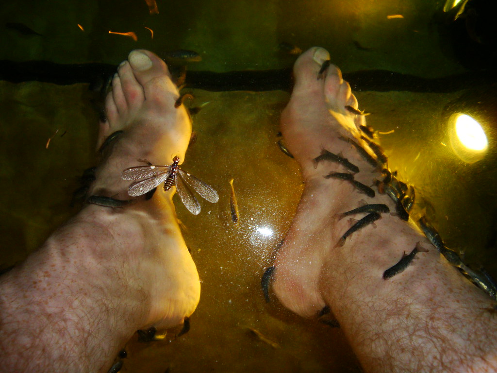FISH EATING DEAD SKIN OFF FEET. Richard Smith Flickr