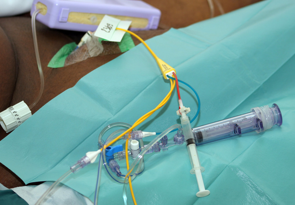 Cathéter de type SwanGanz Positionné ici en fémoral Flickr