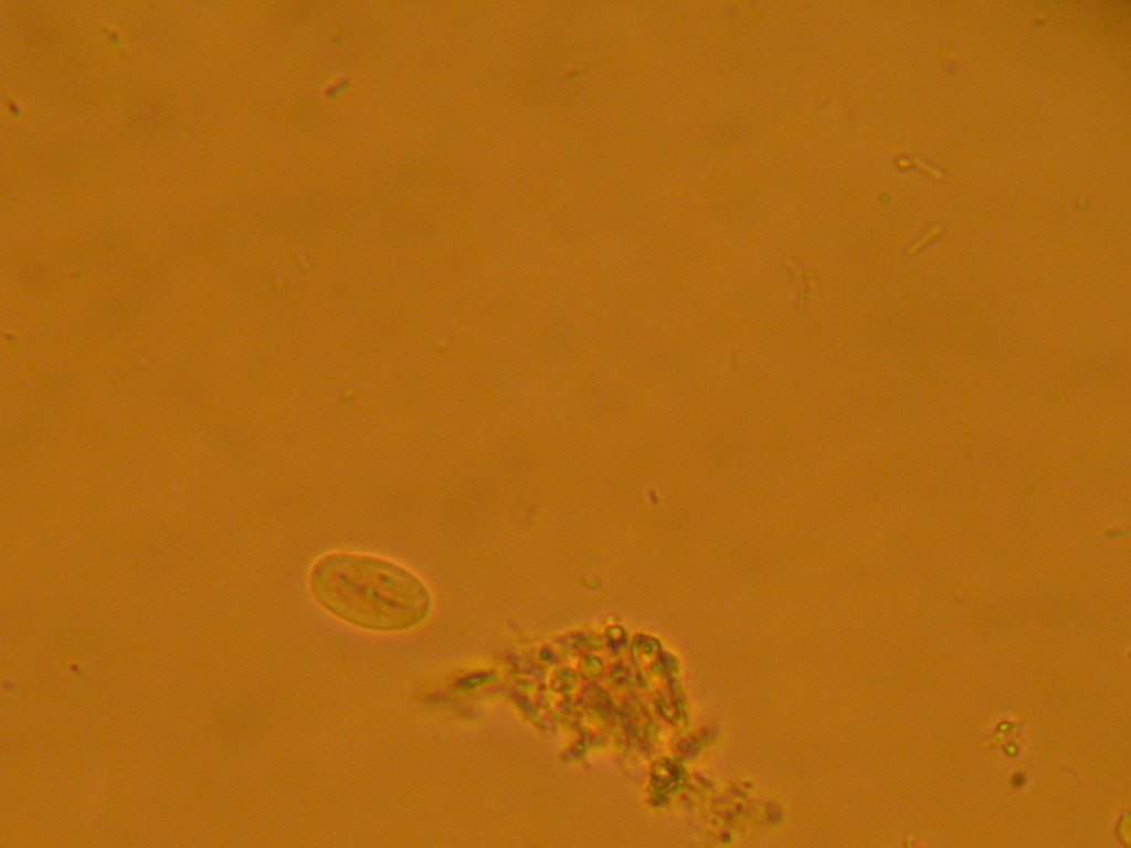 quiste de giardia Tecnologia Medica Flickr