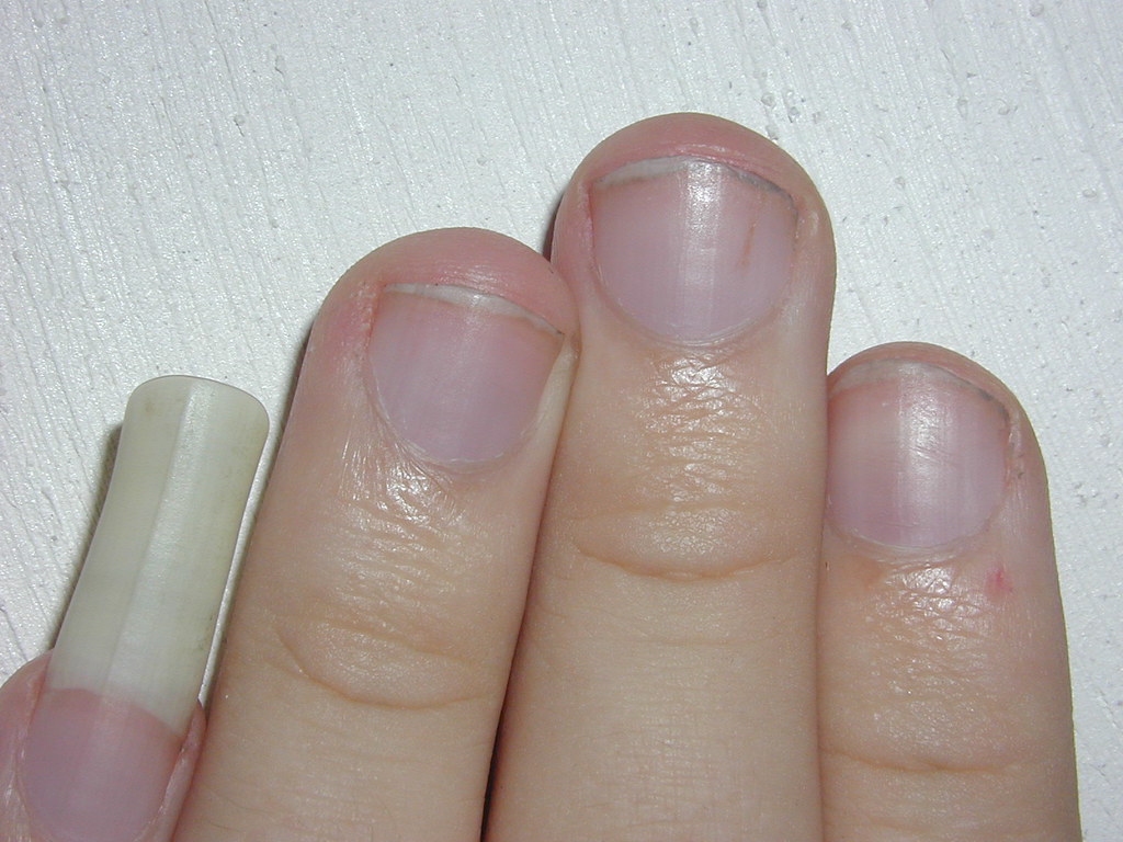 my long pinky nail Thomas Strömberg Flickr