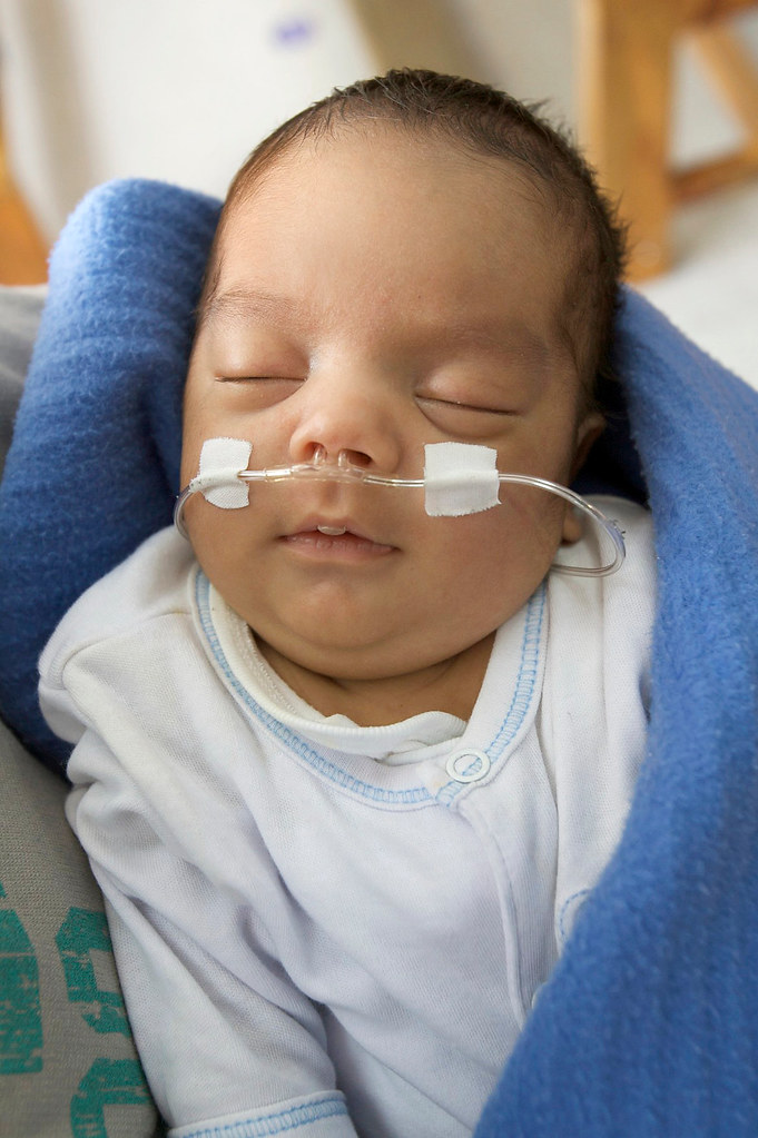 Kangaroo Mother Care a leap in warmth and safe, quality care for premature babies (Bogota