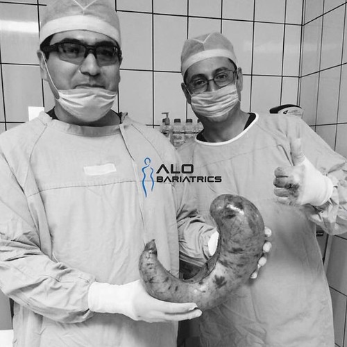 Weight Loss Surgery In Tijuana Alo bariatric Center Flickr