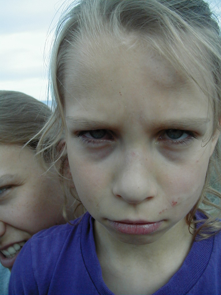 Ow Water Lily scraped her leg, arm and face, falling on th… Flickr