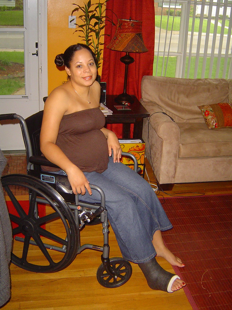 2photo Aha.....the new fiberglass cast. Now, mami can move… Flickr