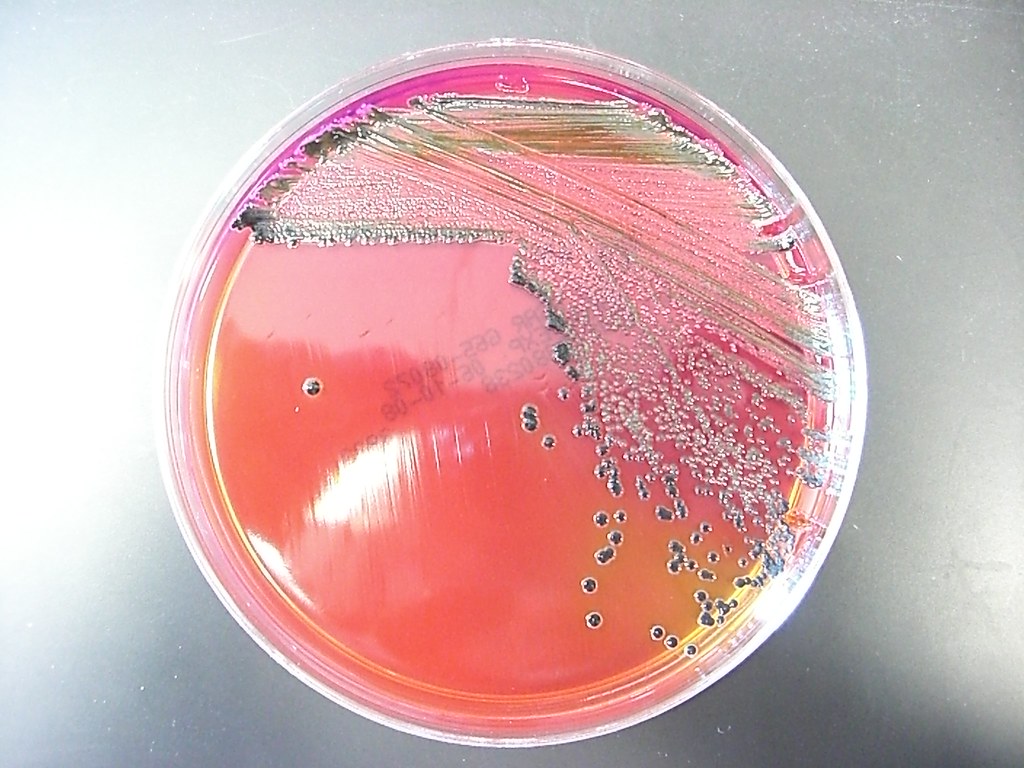 Xld Agar