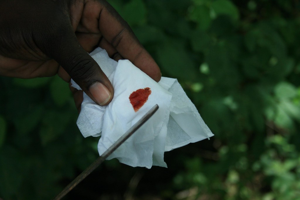 tree sap or is it blood it's tree sap Adam Greig Flickr