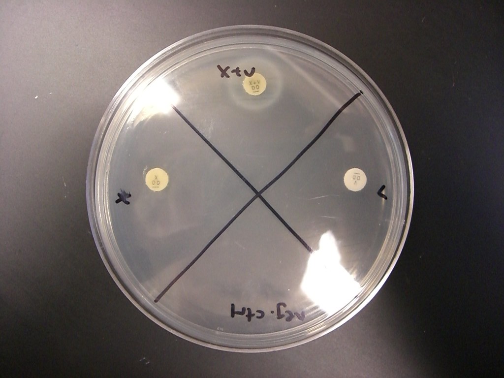 Haemophilus influenzae X and V Factor Test Flickr
