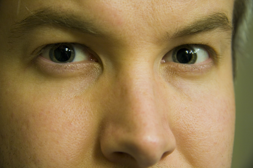 After the eye exam I had an eye exam today, and so had