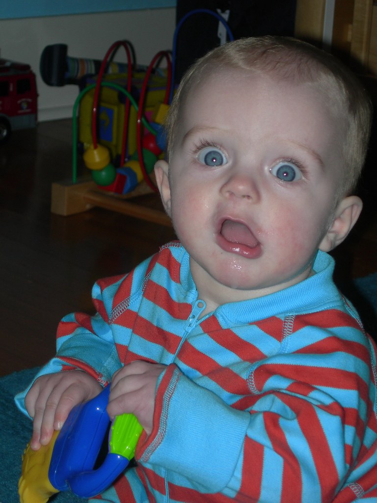 Stroke Baby left sided facial droop Sacha Digi Flickr