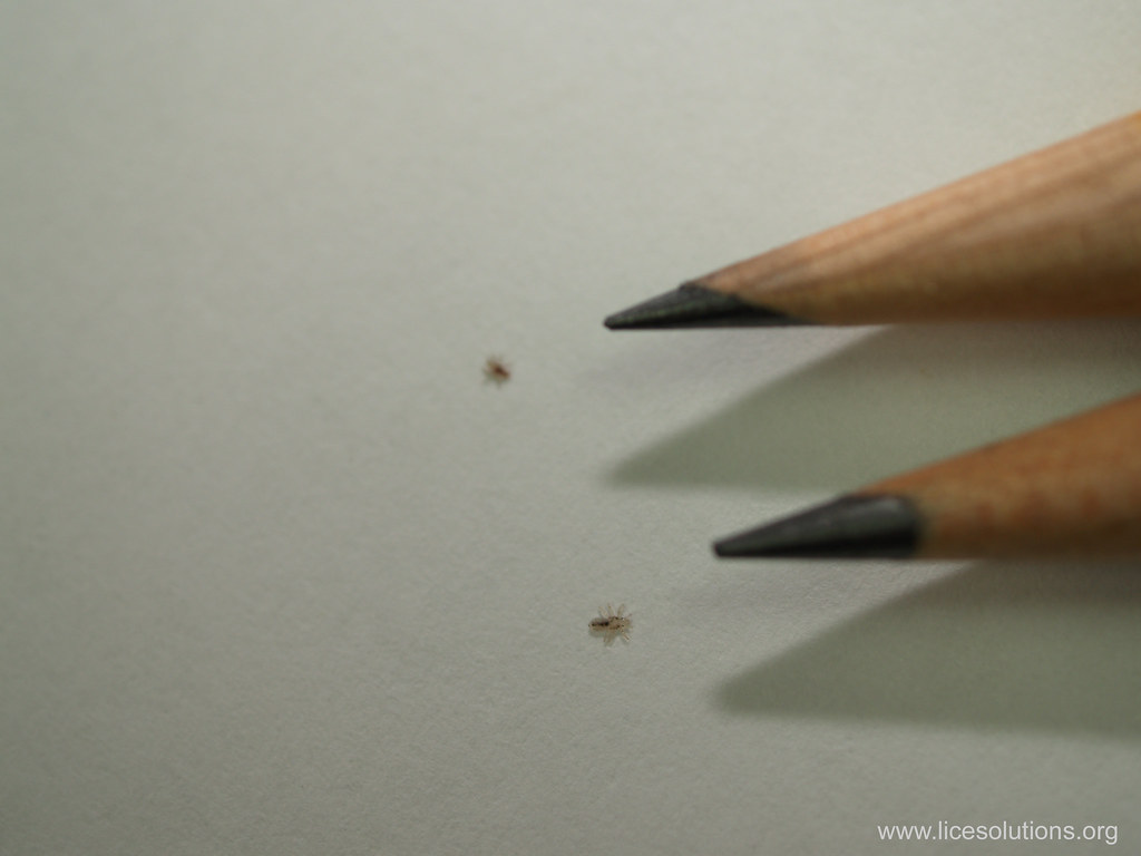 Head Lice Two Nymphs off Head The small size of two nymp… Flickr