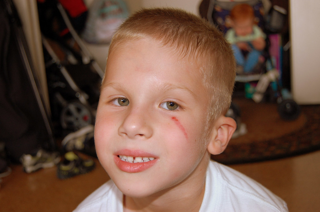 Face Scratch at School Bruno Pion Flickr