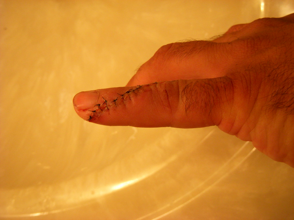 Hand Injury I cut my hand on the miter saw pictured here … Flickr