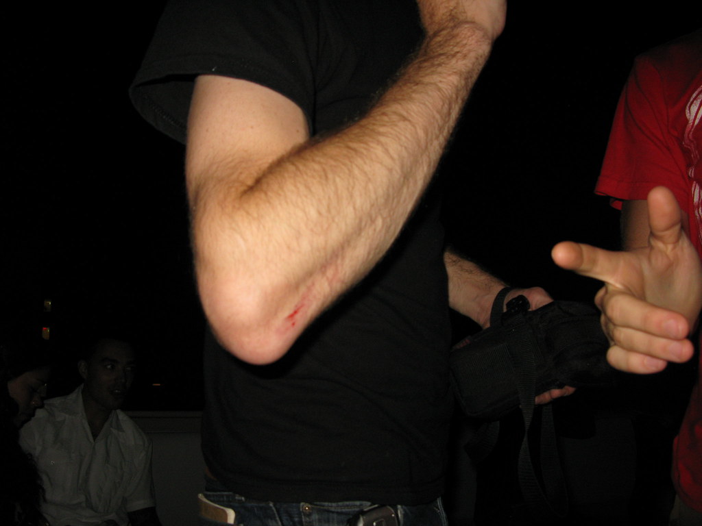 Warning... Yeah.. Jumping shots are dangerous. This grueso… Flickr