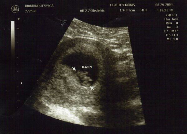 Ultrasound 7 weeks & 4 days This is our very first ultraso… Flickr