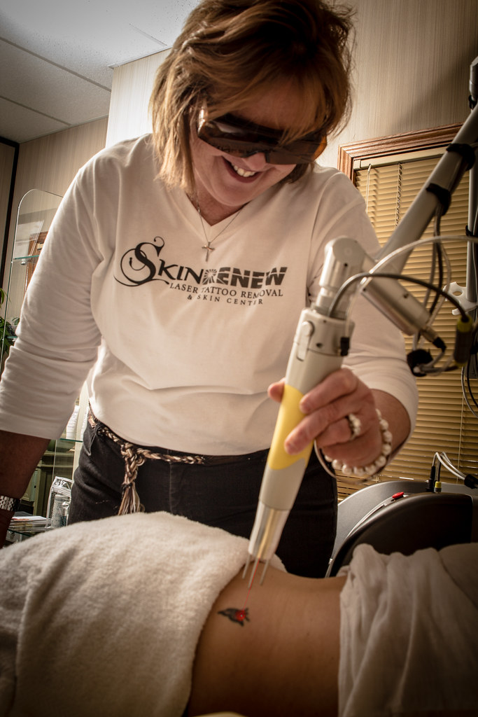 Skin Renew_9858Edit Broad Ripple Magazine Skin Renew Lase… Flickr