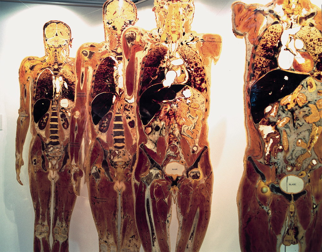 0807.JPG_full_body_plastination_plastinated_body_slices Flickr