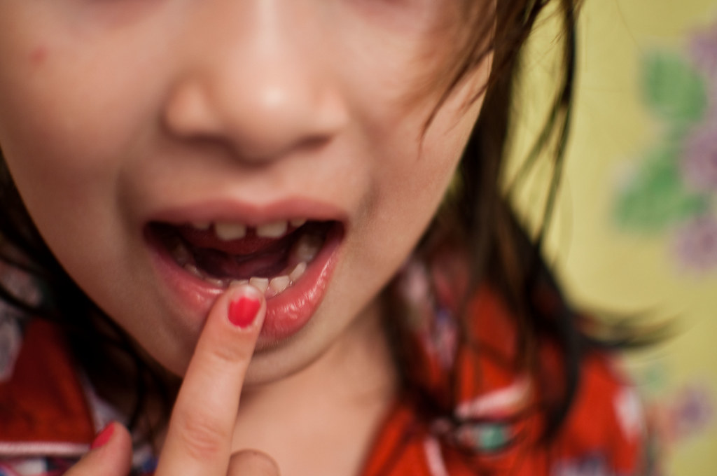 55 Wiggly Tooth My daughter got her first wiggly tooth t… Flickr