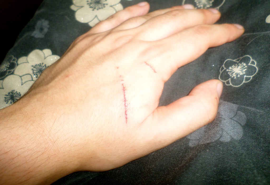 Cat Scratch On Hand Scratched by Pixel. Andrew Chooah Flickr