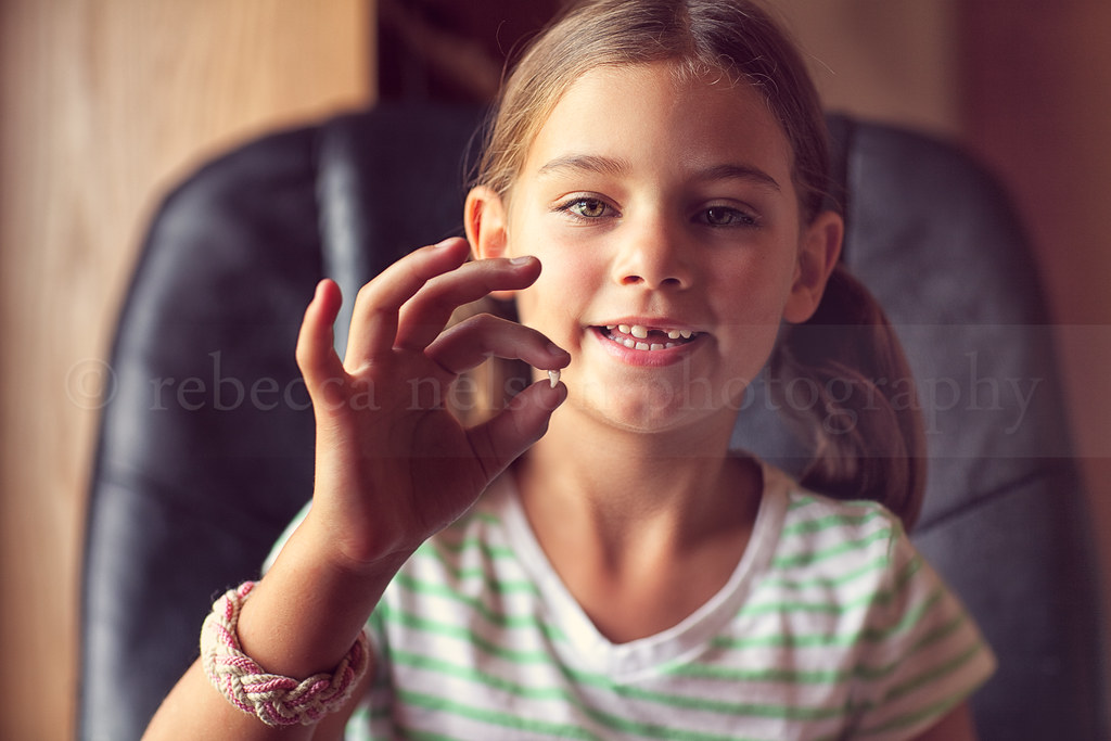 Finally! This tooth was hanging by a thread for weeks