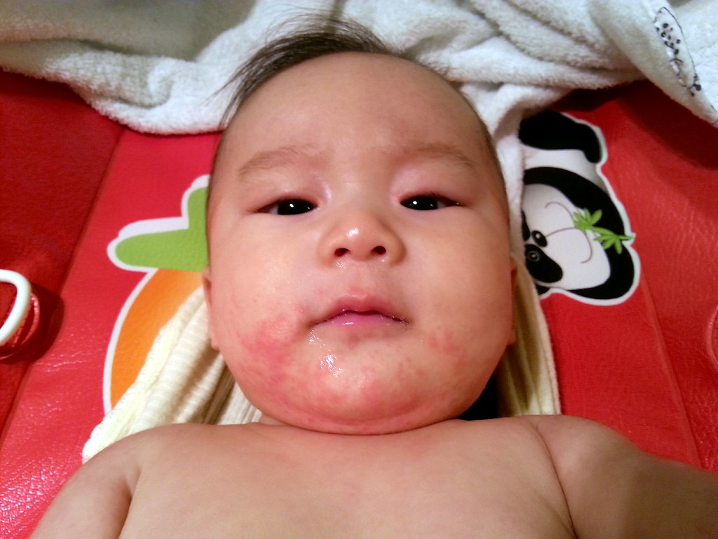 Liam's dribble rash 5 o'clock shadow we try to wipe it cle… Flickr