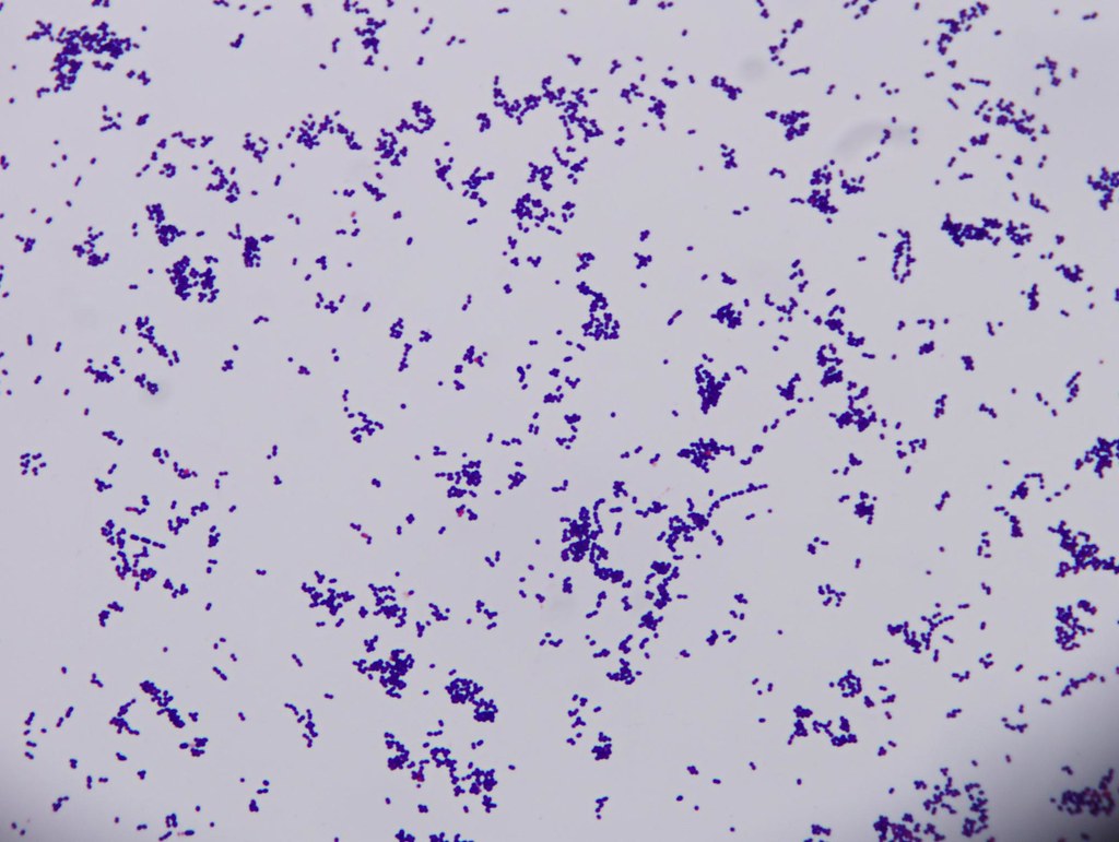 Streptococcus Gram Stain Morphology