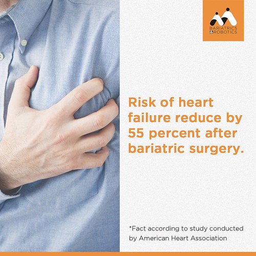 Bariatric Surgery reduce risk of Heart failure Bariatric s… Flickr