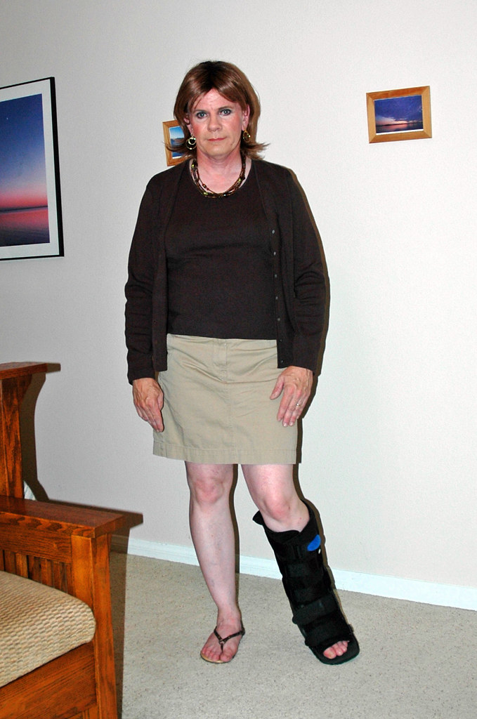 Lovely boot cast for broken toe bone Kris Green Flickr