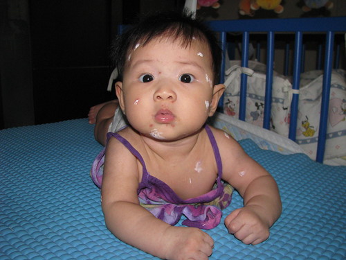 Peak of chicken pox outbreak | Lyn & En Tay | Flickr
