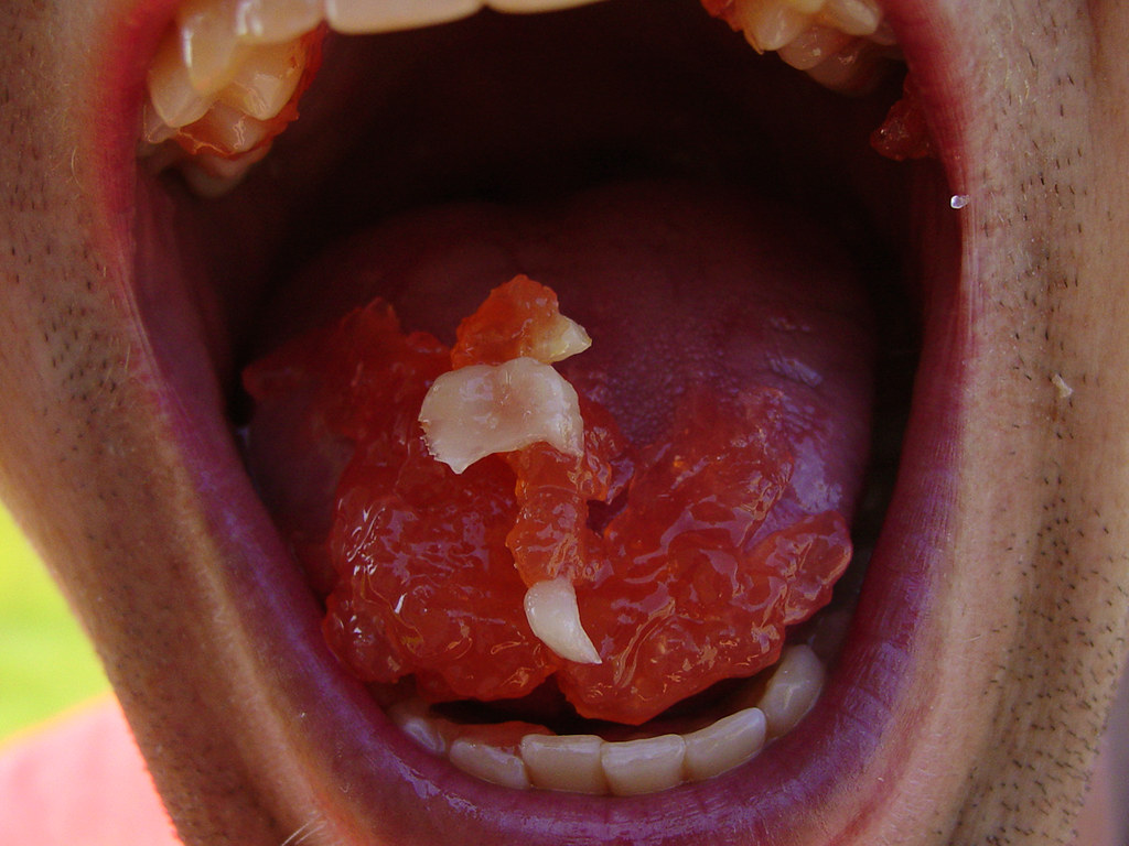 Candy bad for teeth jeff_mette Flickr