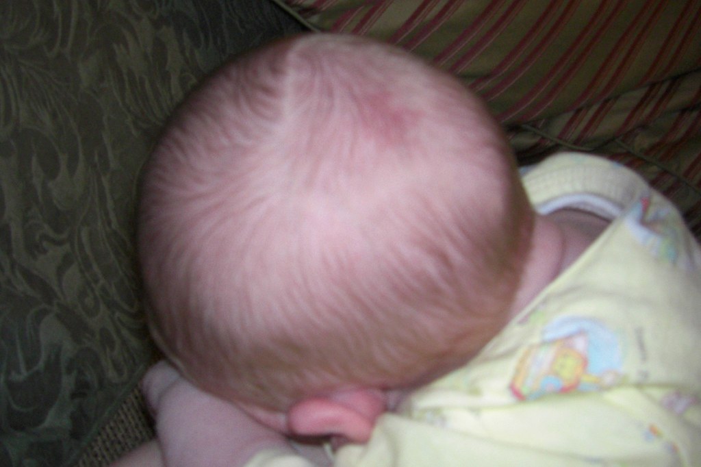 He has a little birthmark on the top of his head and a 'st