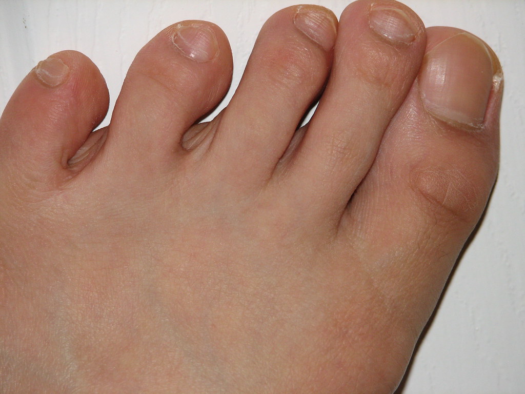 left foot My Left Foot. If you think it's gross, you shoul… Flickr